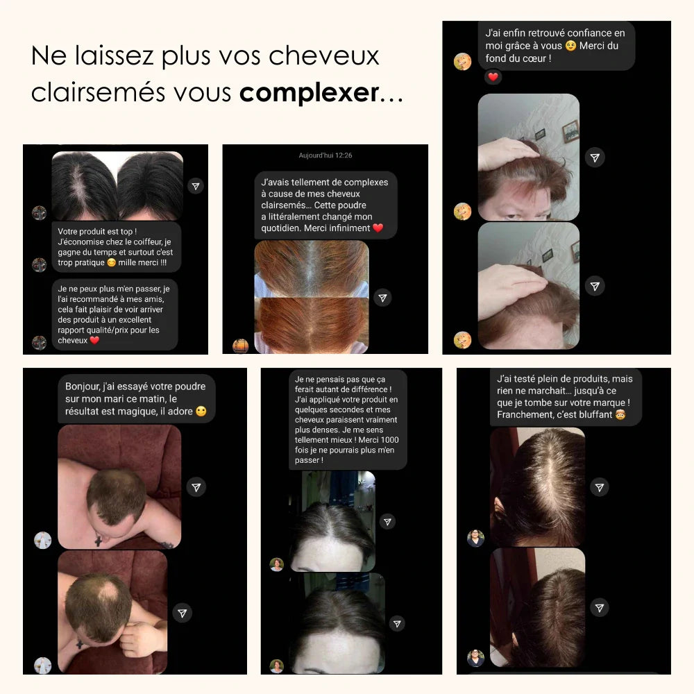 Camouflage capillaire | Femme