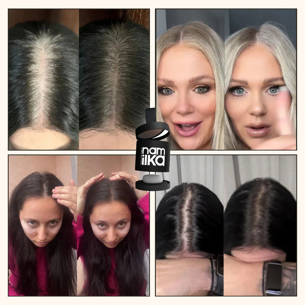 Camouflage capillaire | Femme