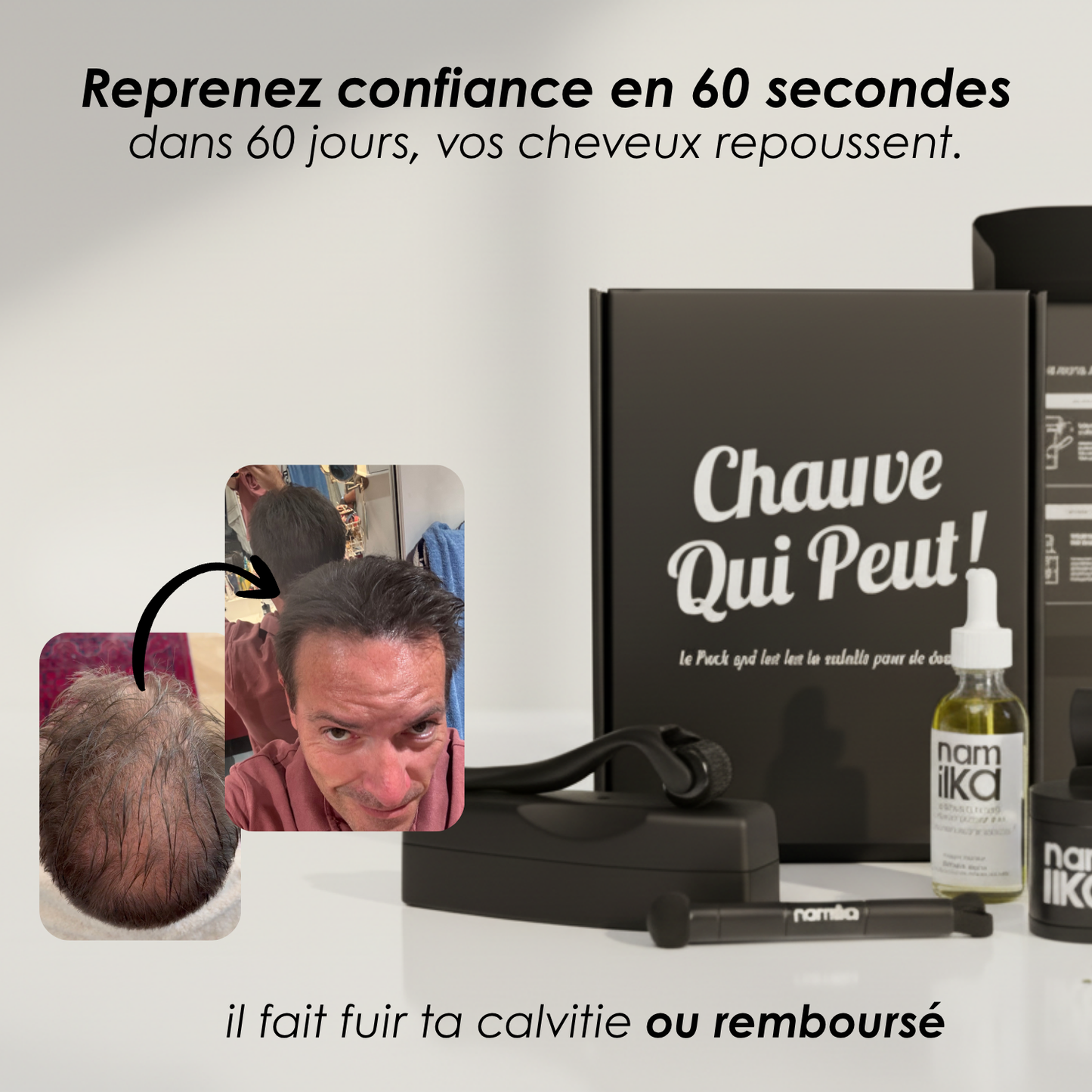 Pack - Chauve Qui Peut