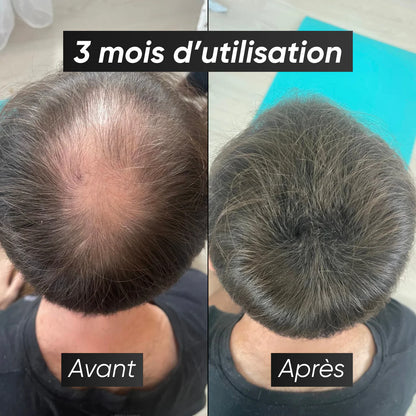 Pack - Chauve Qui Peut