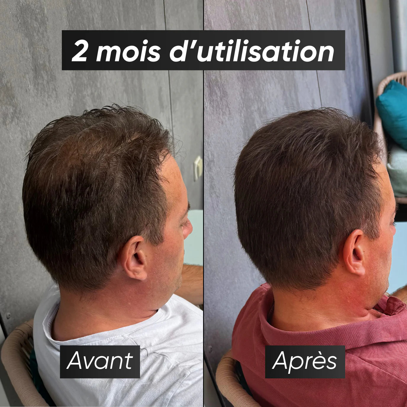 Pack - Chauve Qui Peut